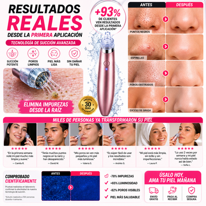 Piel radiante sin puntos negros resultado extractor Aminel