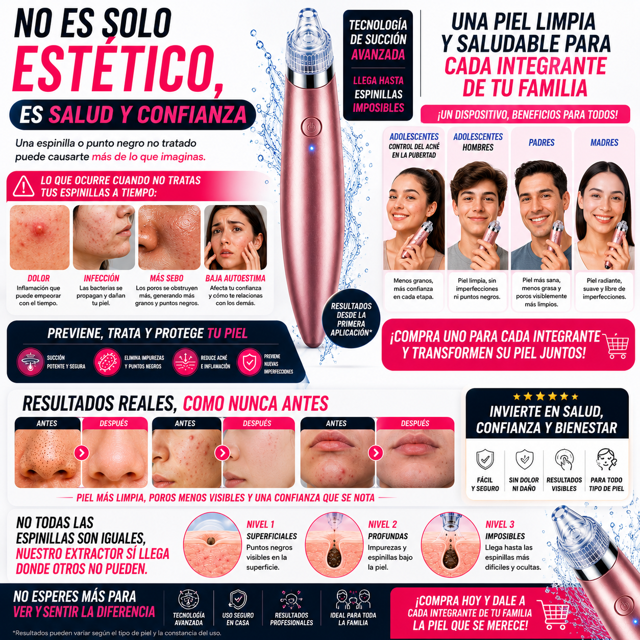 Clientas satisfechas extractor puntos negros Aminel skincare