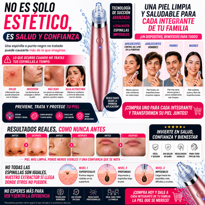 Clientas satisfechas extractor puntos negros Aminel skincare